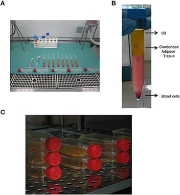 The Collection of Adipose Derived Stem Cells using Water–Jet Assisted Lipoplasty for their Use in Plastic and Reconstructive Surgery: A Preliminary Study